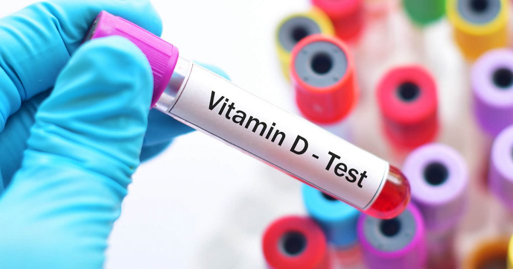 Test vitamina D